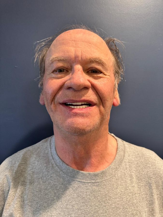 Secure Dental patient smiling after treatment
